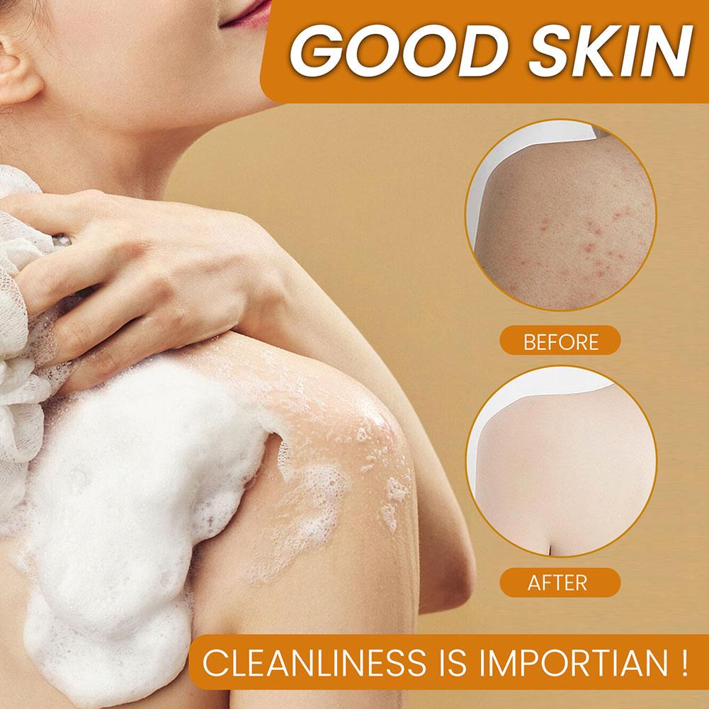 100g Turmeric Hand Made Soap, Lemon Kojic Acid Soap, Shower and Facial Soap Deep Cleaning For Face Body Skin Care