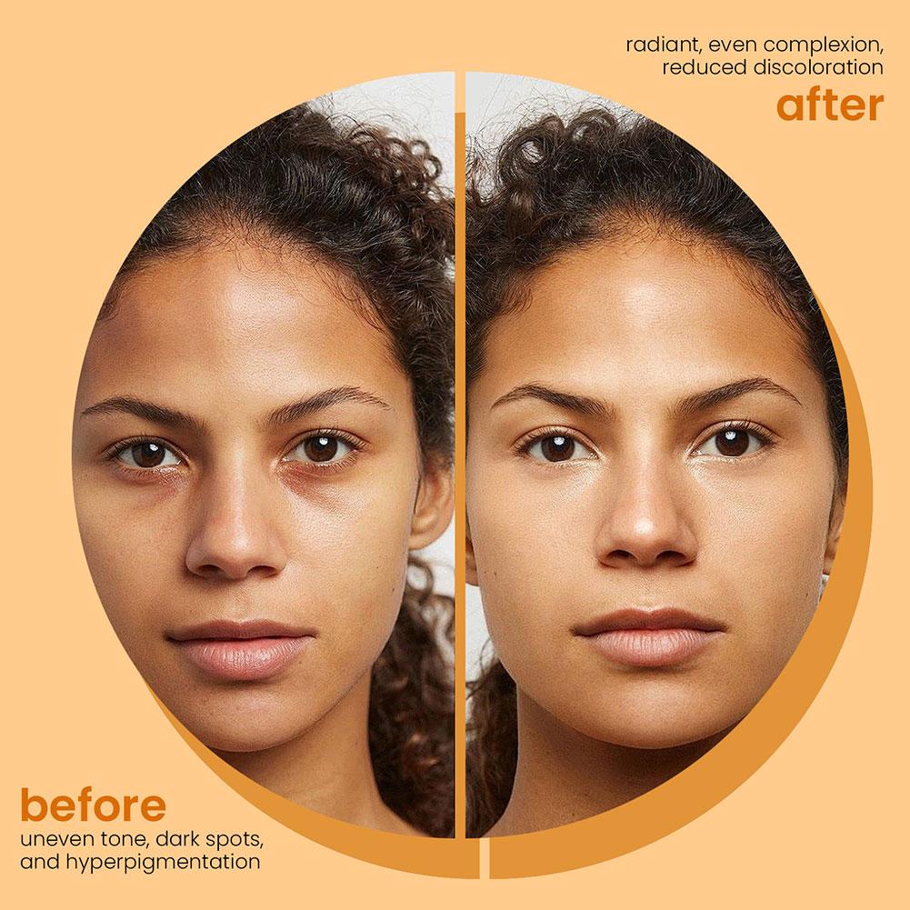 100g Turmeric Hand Made Soap, Lemon Kojic Acid Soap, Shower and Facial Soap Deep Cleaning For Face Body Skin Care