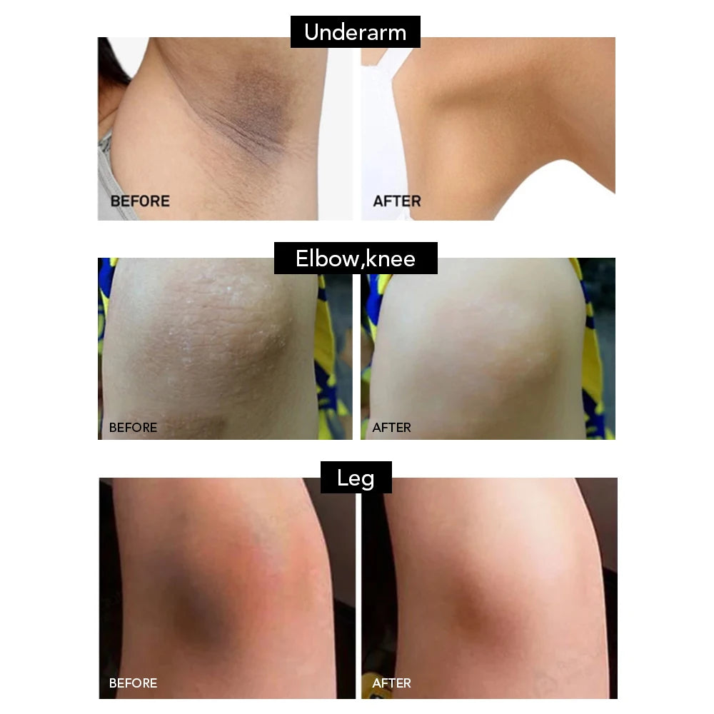 AILKE African Natural Black Soap for Face and Body, Brightening Skin, Reduce Acne, Deep Cleansing, Oil Control, Moisturizing