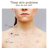 100g Natural African Black Soap With Organic Shea Butter Anti Rebelles Treatment Acne Moisturizing SkinCare Handmade Body Bath