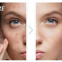 AILKE African Natural Black Soap for Face and Body, Brightening Skin, Reduce Acne, Deep Cleansing, Oil Control, Moisturizing