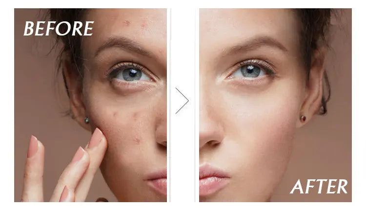 AILKE African Natural Black Soap for Face and Body, Brightening Skin, Reduce Acne, Deep Cleansing, Oil Control, Moisturizing