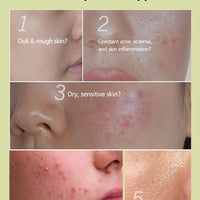 100g AFRICAN BLACK SOAP Shea Butter Bar Moisturizing Acne Treatment Cleanser for Clear Skin Care Deep Cleaning Glowing