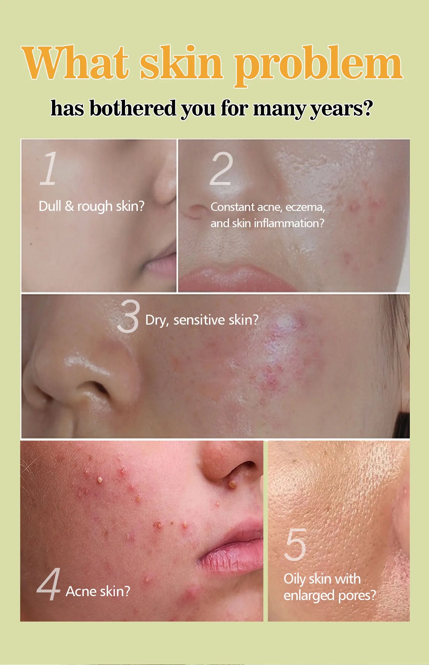 100g AFRICAN BLACK SOAP Shea Butter Bar Moisturizing Acne Treatment Cleanser for Clear Skin Care Deep Cleaning Glowing