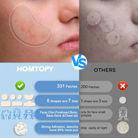 331 Patches Large Pimple Patches Hydrocolloid Acne Patch Skincare Blemishes Zit Breakouts Bandages Big Spot Covers for All Skin