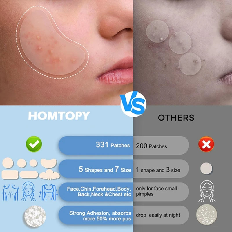 331 Patches Large Pimple Patches Hydrocolloid Acne Patch Skincare Blemishes Zit Breakouts Bandages Big Spot Covers for All Skin