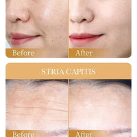 10pcs SADOER Collagen Anti Wrinkle Face Mask Moisturizing Anti aging Repair Brightening Facial Masks Skin Care