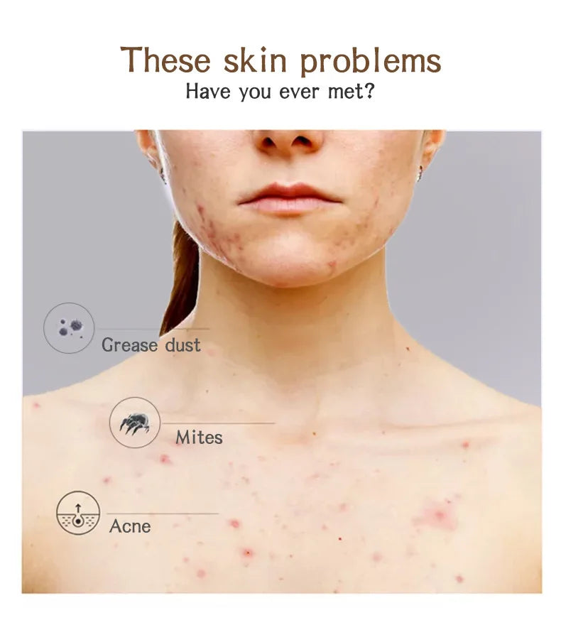 African Black Soap Raw Black Body Cleaning Bath Soap Essential Oil Handmade Soap