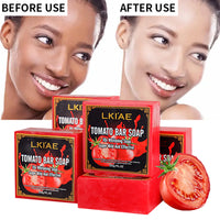 AILKE Organic Tomato Soap Bar, Lightening Skin, Deeply Clean, Exfoliate, Remove Dark Spots, Moisturizing, For Face and Body