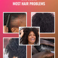 100% Pure Batana Oil From Honduras Natural Batana Butter For Hair Growth Alopecia Areata Hair Loss Treatment For Men & Women