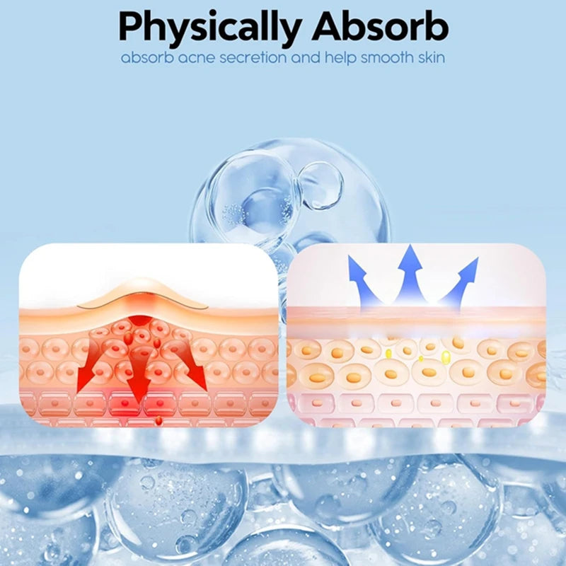 331 Patches Large Pimple Patches Hydrocolloid Acne Patch Skincare Blemishes Zit Breakouts Bandages Big Spot Covers for All Skin