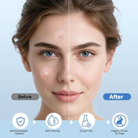 331 Patches Large Pimple Patches Hydrocolloid Acne Patch Skincare Blemishes Zit Breakouts Bandages Big Spot Covers for All Skin