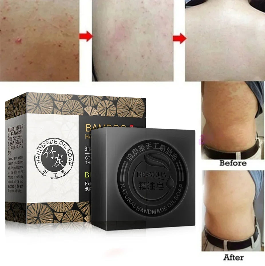 100g Bamboo Charcoal Handmade Soap Skin Moisturizing Deep Cleansing Oil Control Blackhead Remover Face Wash Hair Bath Skin Care