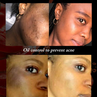 AILKE Organic Tomato Soap Bar, Lightening Skin, Deeply Clean, Exfoliate, Remove Dark Spots, Moisturizing, For Face and Body