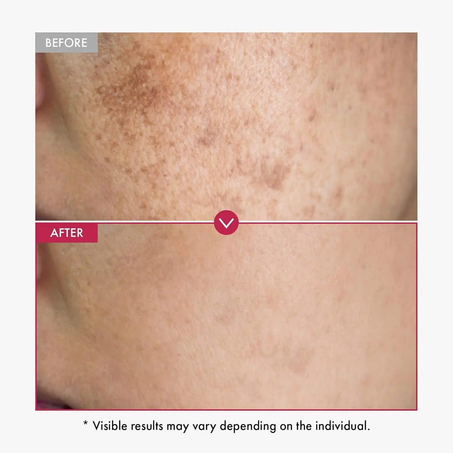 Alpha Arbutin Serum AHA Keeps Face And Body Serum Smooth Brightening Moisturizing Improving Dullness Dark Skin Beauty Care Cream