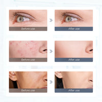 7 Colors LED Silicone Beauty Machine Skin Care Face Mask for Home Use